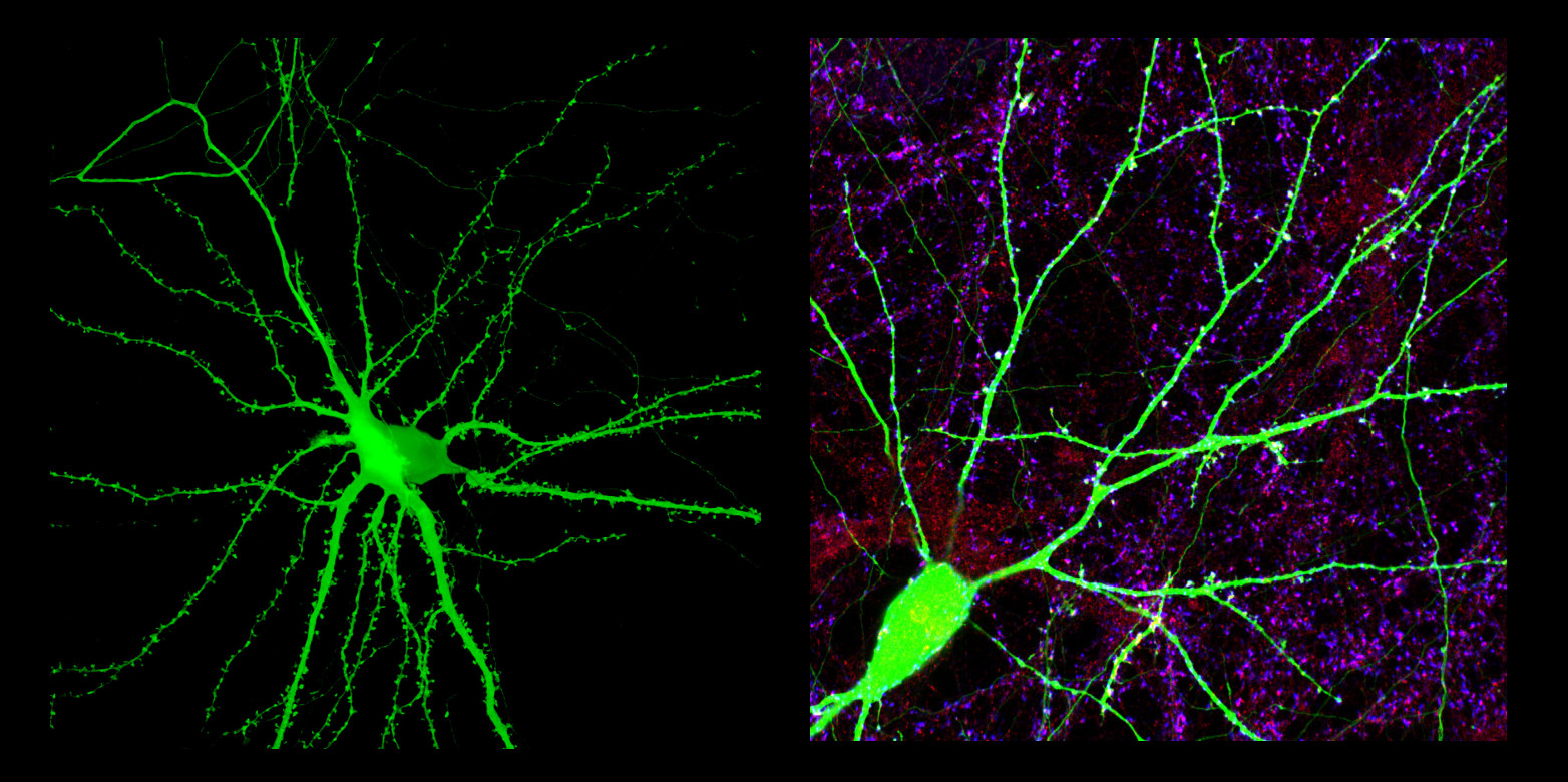 eth zurich neuroscience