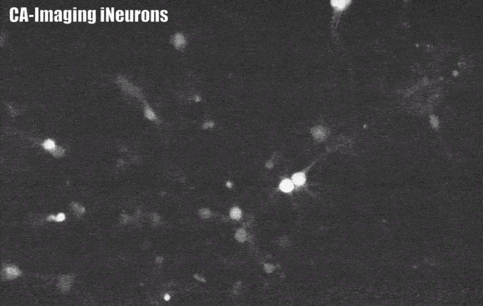 CA imaging of ineurons